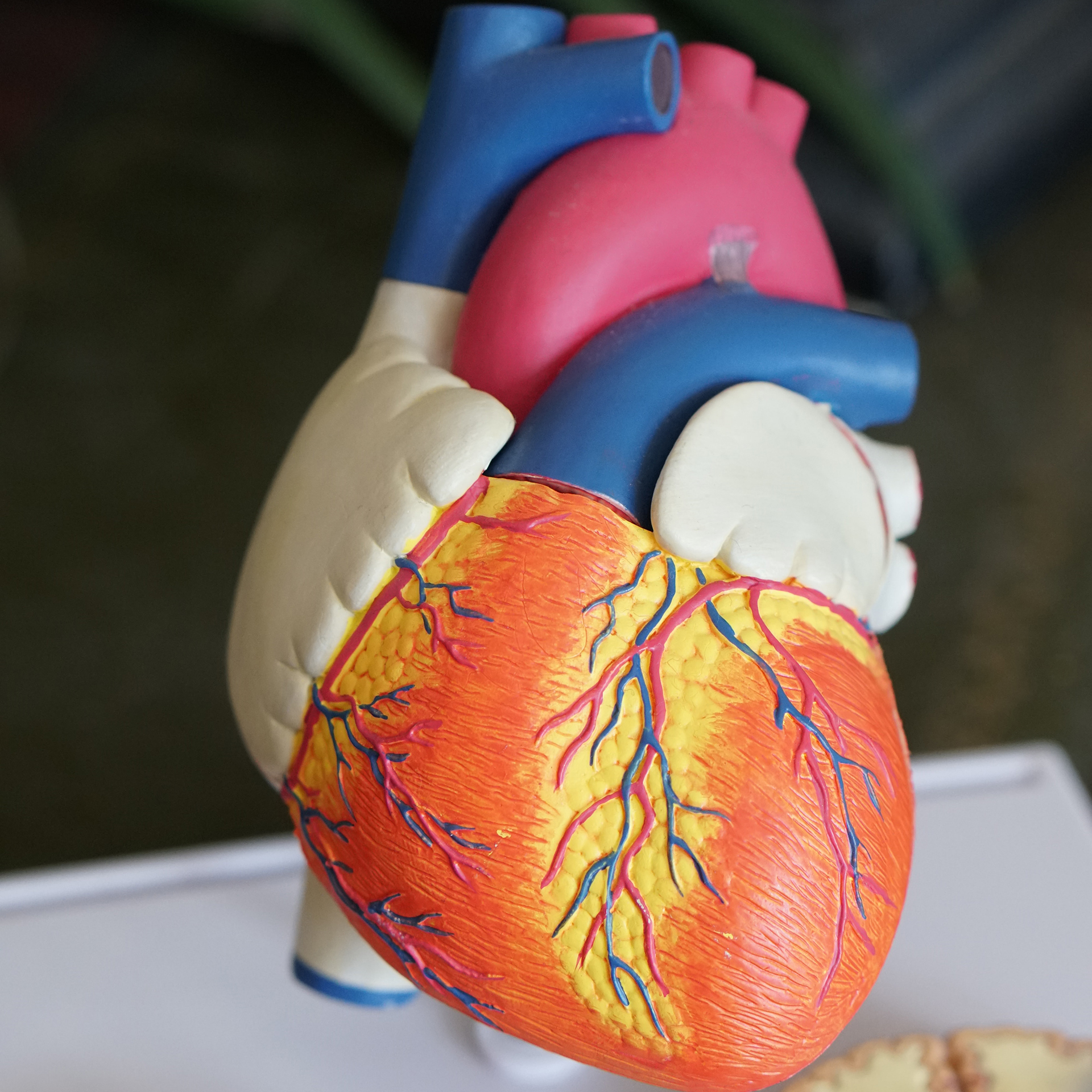 Heart Disease Is Often Subtle In Women