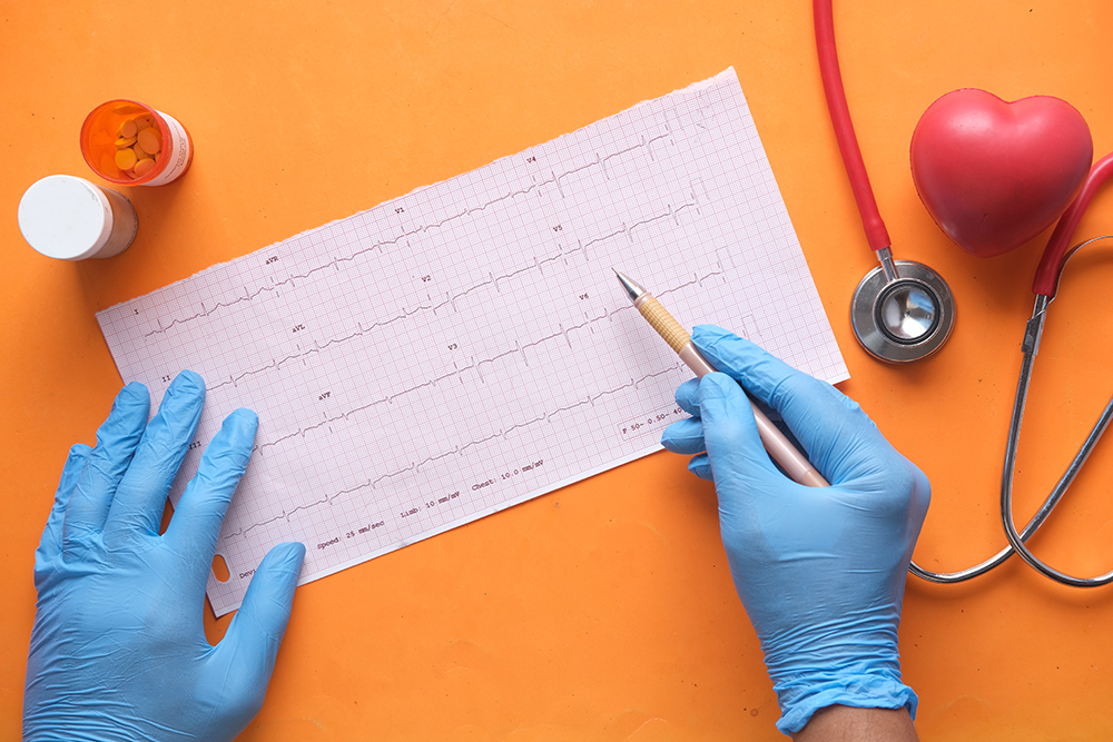 Ask a Health Care Professional – Heart Health