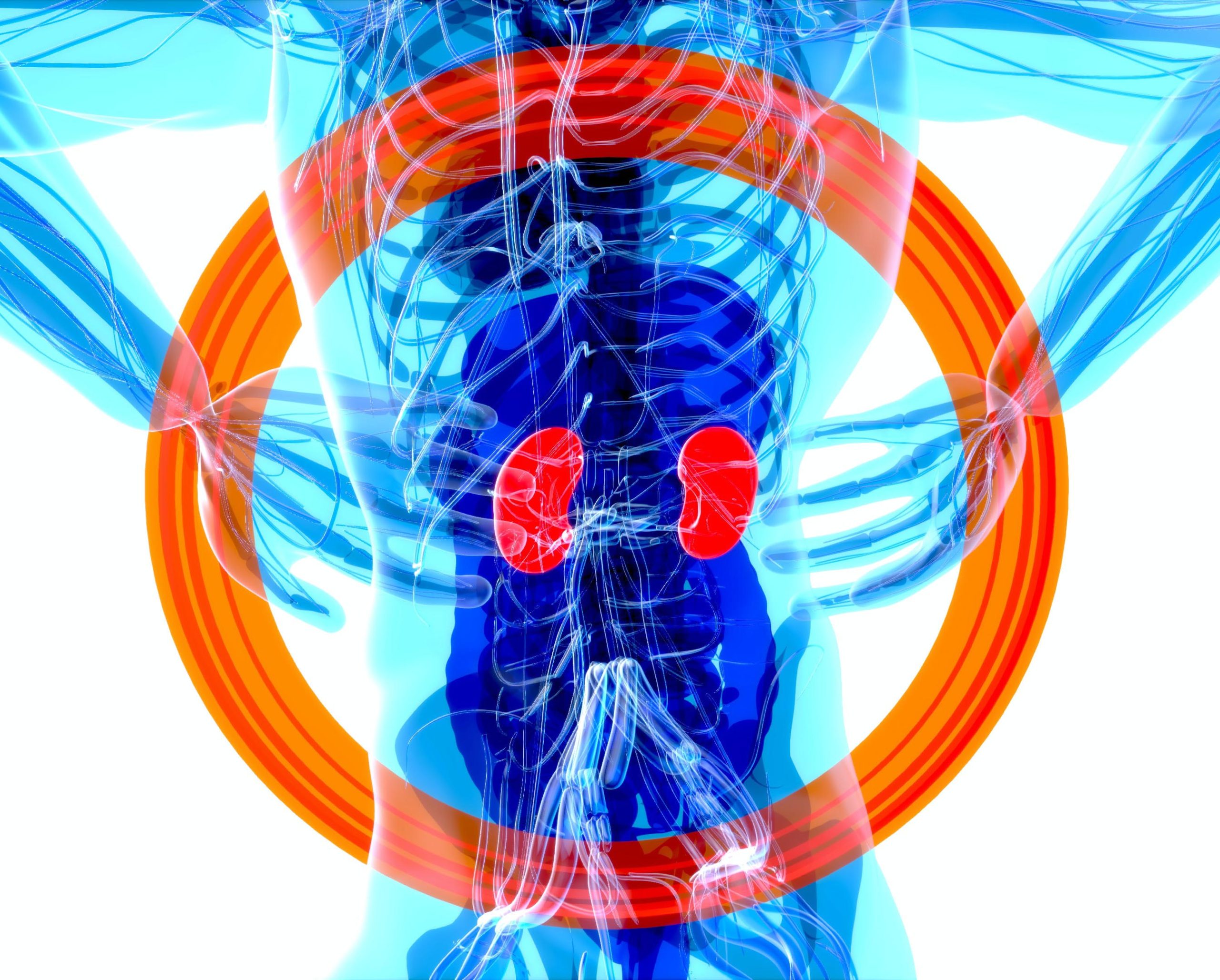 Chronic Kidney Disease